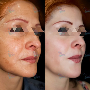 Slider image (8) Dr. Fernando Munar - Plastic Surgery